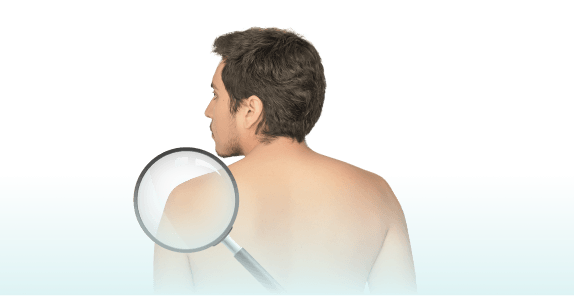 Bare back of a person with a magnifying glass highlighting the shoulder area.